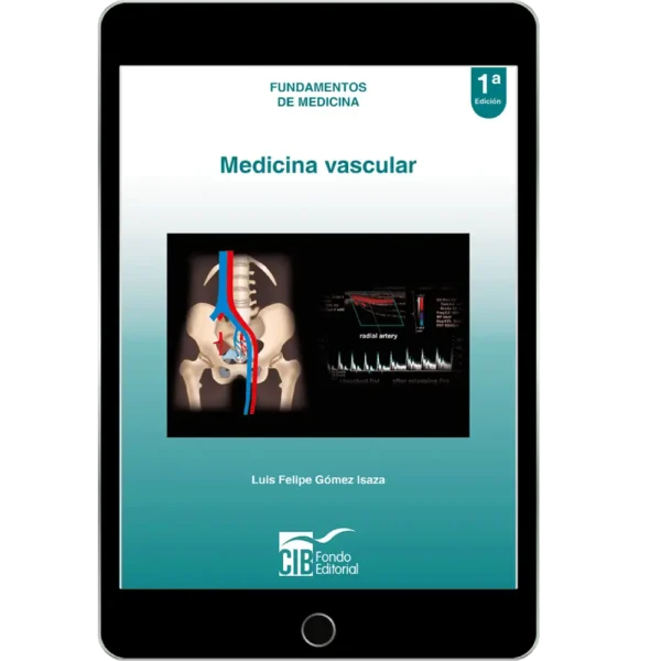 Portada | Medicina vascular